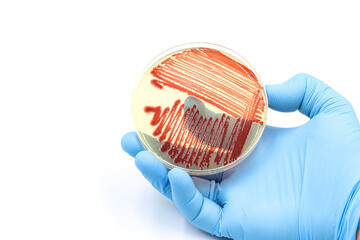 Hand of a researcher showing a close-up of a microbiological culture plate with red bacteria
