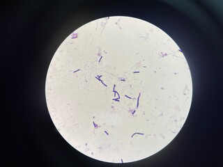 A microorganism, also known as a microbe, is a tiny living organism that is usually too small to be...