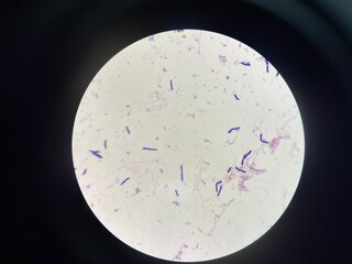 A microorganism, also known as a microbe, is a tiny living organism that is usually too small to be...