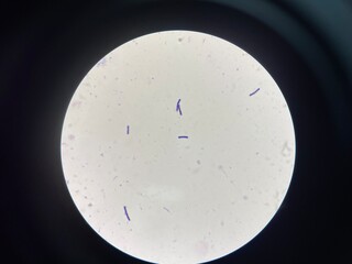 A microorganism, also known as a microbe, is a tiny living organism that is usually too small to be...