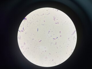 A microorganism, also known as a microbe, is a tiny living organism that is usually too small to be...