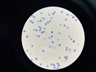 A reticulocyte is an immature red blood cell (RBC) that has recently been released from the bone...