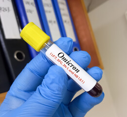 Blood sample for SARS CoV-2 Omicron subvariant LF.7, XFG, JN-1, NB 1.8.1 'Centaurus' virus mutation test at medical laboratory.