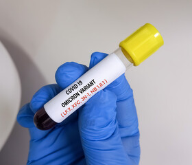 Blood sample for SARS CoV-2 Omicron subvariant LF.7, XFG, JN-1, NB 1.8.1 'Centaurus' virus mutation test at medical laboratory.