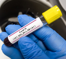 Blood sample for SARS CoV-2 Omicron subvariant LF.7, XFG, JN-1, NB 1.8.1 'Centaurus' virus mutation test at medical laboratory.