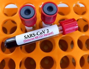 Blood sample for SARS CoV-2 Omicron subvariant LF.7, XFG, JN-1, NB 1.8.1 'Centaurus' virus mutation test at medical laboratory.