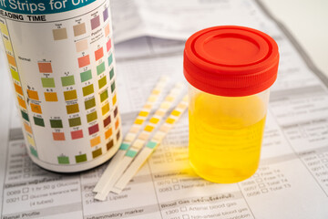 Urinalysis, urine cup with reagent strip pH paper test and comparison chart in laboratory.