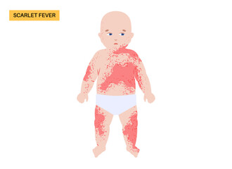 Scarlet fever poster.