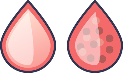 Two stylized blood drops. One is clear, representing healthy blood. The other contains particles, symbolizing impurities, blood cells, or a blood disorder like thrombosis or anemia.