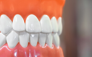 Dental anatomy models showing teeth structure and jaw demonstration