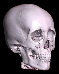 3D reconstruction image results of the head from a radiological CT scan examination