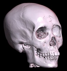 3D reconstruction image results of the head from a radiological CT scan examination