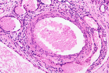 Muscular artery. Smooth muscle fibers in the tunica intima