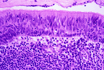 Pharyngeal tonsil epithelium