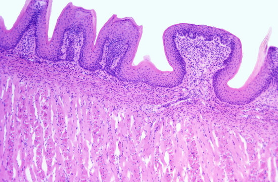 Tongue. Fungiform papilla.