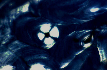 Bone tissue. Polarised light