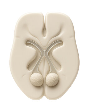 Hypothalamus section highlighting the optic chiasm and mammillary bodies