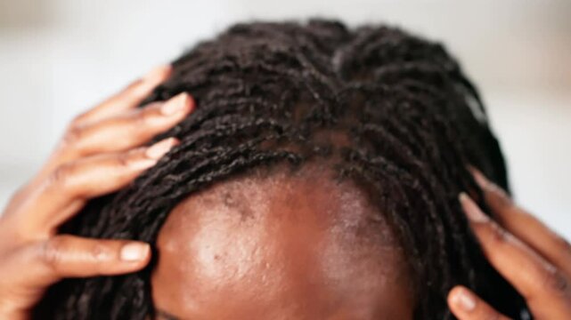 Hair Dandruff And Itchy Scalp Problem