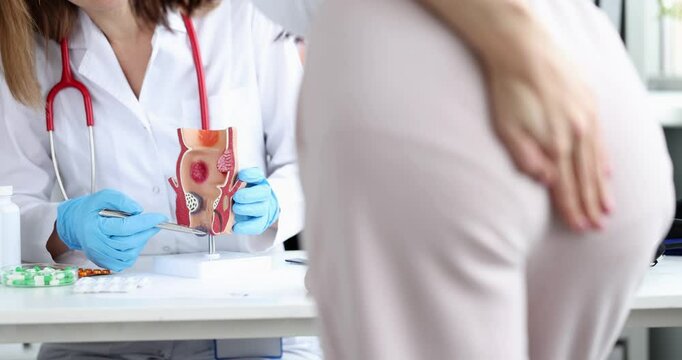 Doctor shows hemorrhoids development on rectum plastic model to woman covering back in hospital. Pain in anus causes pain and shows potential disease