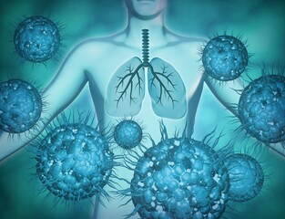 Virus cells attacking human lungs, contagious, respiratory illness concept 3d illustration.