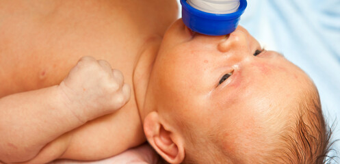 Newborn baby with jaundice sucks formula. Close-up portrait