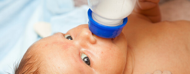 Newborn baby with jaundice sucks formula. Close-up portrait