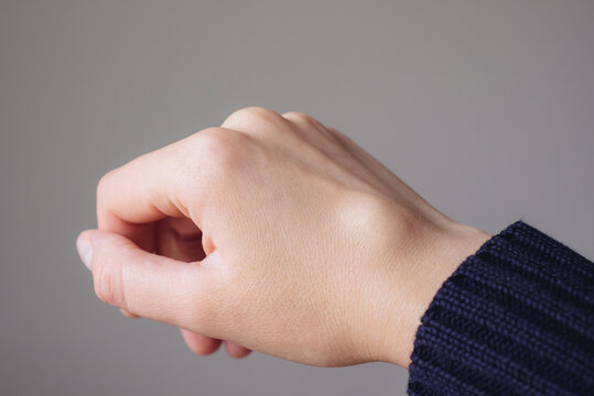 Female right back hand with ganglion cyst on the dorsum,  fluid-filled bump associated with a joint or tendon sheath, close-up view, selected focus.