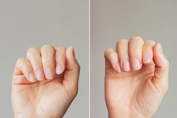 Sierkussen Nagelstudio Close-up comparison before and after of a well-groomed female hands with a beautiful nude manicure on a gray background. Beauty and hand care  © Ольга Шефер