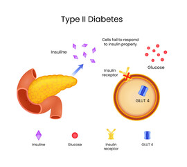 Type II Diabetes Insulin Resistance Explained