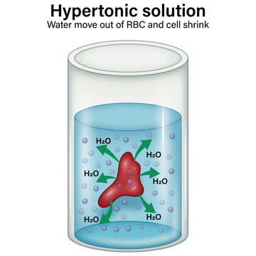 Hypertonic Solution Effect on Red Blood Cell &ndash; Water Loss and Cell Shrinkage Illustration

