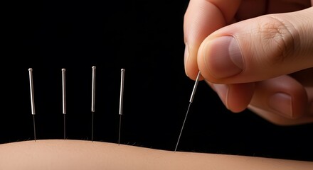 Acupuncturist's hand carefully inserting a needle into a patient's back during an acupuncture session.