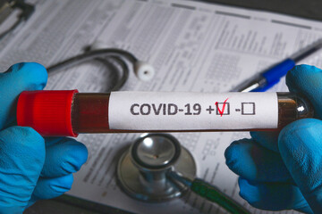 Doctor showing positive test result for covid-19 with blood sample in test tube
