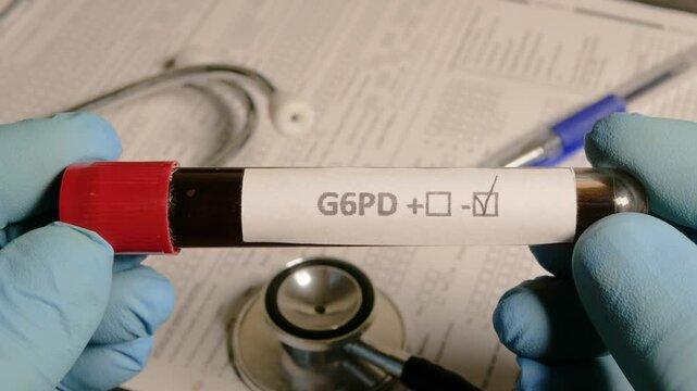 Doctor showing blood sample positive for g6pd deficiency