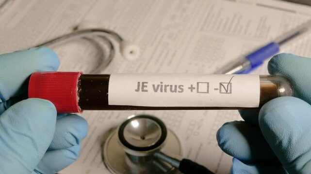 Doctor holding blood sample positive for je virus