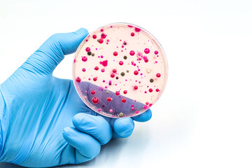 Microbiological culture with colonies of bacteria, fungi and yeasts. Space fro text