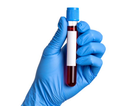 Gloved Hand Holding Blood Sample Tube Upright, Front View Close-Up, Isolated on Transparent Background”.