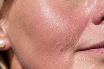 High-resolution macro image of a mature woman's cheek showing skin texture, fine lines, pores, and natural imperfections under sunlight.