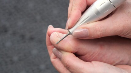 Close-up of a professional performing toenail care using an electric drill, focusing on precision