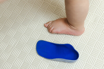 Child's foot with valgus deformity near an individual orthopedic plastic shoe insole in rehab...