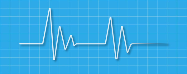 Electrocardiogram medical background. Blue Heart pulse monitor with signal. EKG showing normal sinus rhythm. Heartbeat line on blue grid background. Heart monitoring, cardiology, hospital technology 