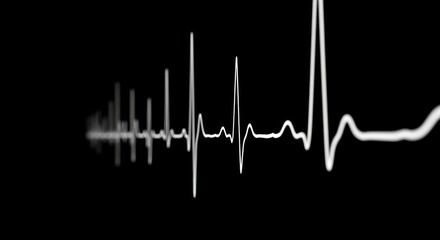 A close-up view of a heart rate monitor tracing, showing a series of rhythmic waves against a black background.