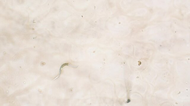 Single nemotode moving in Petri dish agar substrate