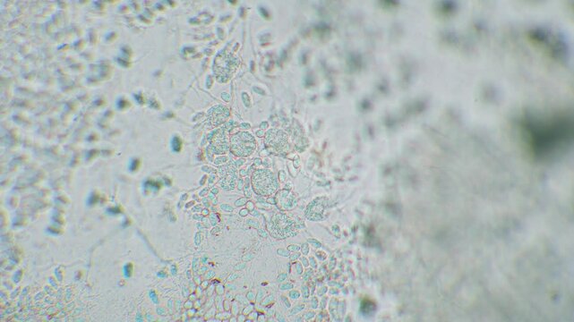 Freshly hatched germinated slime mold spores to amoeba between other spores