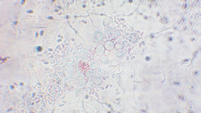 Freshly hatched germinated slime mold spores to amoeba between other spores