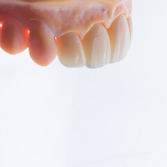 High-quality four dental crowns made of zirconium for fixation to the frontal teeth of upper jaw.