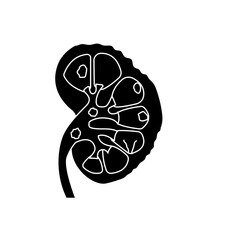 chronic kidney disease