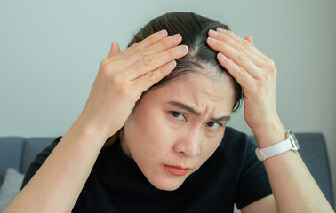 Cropped shot view of Asian woman worrying about her forehead with part of her thin hair, she had hair loss problem. Female pattern hair loss can progress from a widening part to overall thinning.