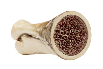 Cross-section of a bone