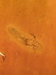Demodex Face Mite Surrounded by Blood Cells Under Microscope