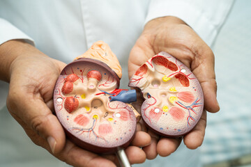 Kidney disease, Chronic kidney disease ckd, Doctor hold human model to treat and study in hospital.